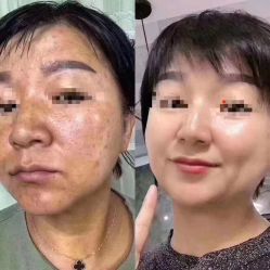 -慕拉美甲美睫皮肤管理