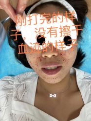 -清华大学玉泉医院-医疗美容科