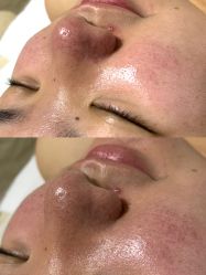 -Hi Beauty Skin 科技美肤中心