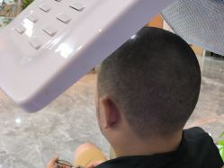 -碧莲盛·不剃发植发