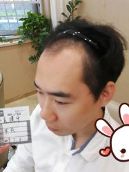 点击看大图 -大麦微针植发丨全国连锁