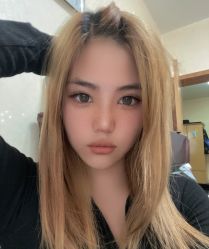 体验后-太原丽都医疗美容医院