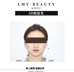 -丽美妍医疗美容·皮秒·立体分层抗衰