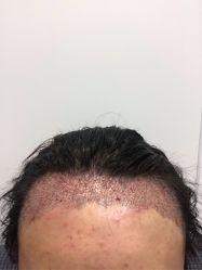 -雍禾植发全国连锁