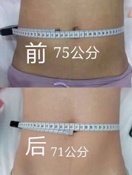 -Lily纤美·科技减脂中心