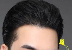 -大麦微针植发丨全国连锁