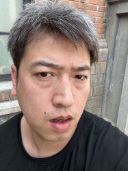 体验前-紫洁俪方（北京）医疗美容