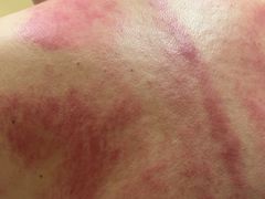 -阮氏中医推拿·颈肩腰腿(世纪公园店)