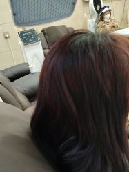 -碧莲盛·不剃发植发