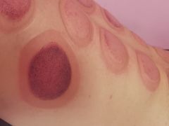 -秦韬盲人按摩院(惠新西街店)