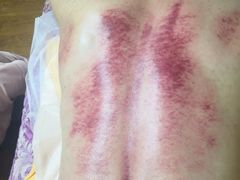 -沈师傅盲人按摩工作室(密三小区店)