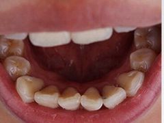 -Dr.Z dental仁康种植矫正中心