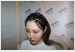 -大麦微针植发全国连锁