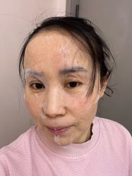 -小忠丽格医美