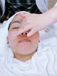 -佳慕·痘痘·问题肌管理中心