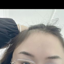 体验后-大华韩艺整形美容医院