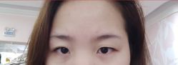 -广州美莱医疗美容医院