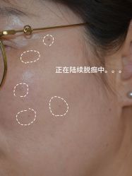 -清疣美疣·痣·斑净肤中心
