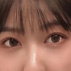 体验后-西安伊美尔医疗美容医院