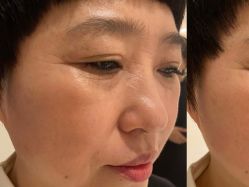 -安吉拉青春化管理中心