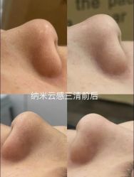 -SKIN79皮肤管理中心