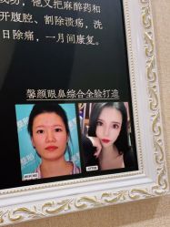 -佛山艺美医疗美容·整形·美肤·塑形