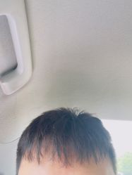 -TABA
