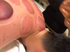 -小徐盲人按摩(新华社区店)