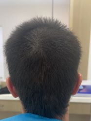 -雍禾植发