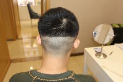 -大麦微针植发丨全国连锁