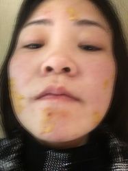 -广东韩妃整形外科医院