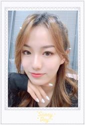 点击看大图 体验后-大麦微针植发全国连锁