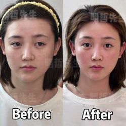 -颜和骨正·明哲式骨相美学整骨