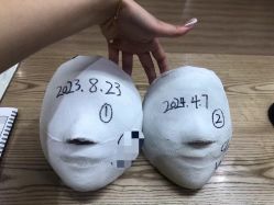 -小颜秘家·韩国整骨
