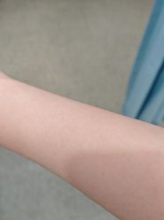 体验后-南京医科大学友谊整形外科医院