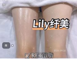 点击看大图 -Lily纤美·科技减脂中心