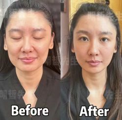 -颜和骨正&明星徒手小颜整骨