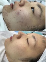 -蕾特恩专业祛痘·皮肤管理