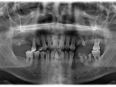 -耀光牙科(南园店)