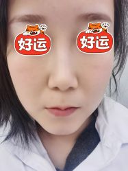 点击看大图 体验后-成都艾特他整形外科医院