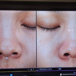-苑苑vbeauty科技美容SPA