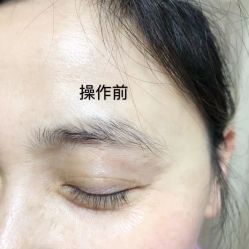 -莲姿娜·半永久纹眉皮肤管理