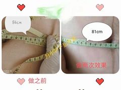 -兰州月小护月嫂·产后恢复