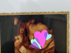 -伊丽莎白妇科医院·早孕检查