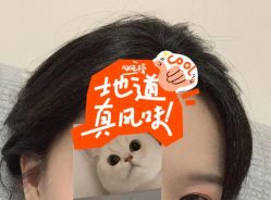 -大麦微针植发全国连锁