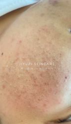 点击看大图 -MLP美丽派·问题肌疗愈中心