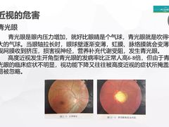 -华彬眼镜专业渐进配镜(潘家园店)