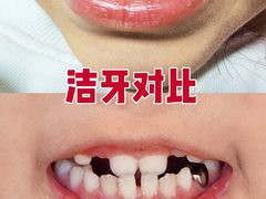 -华西牙科·四川口腔医院