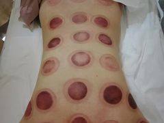 -益友堂盲人推拿正骨穴位按摩工作室