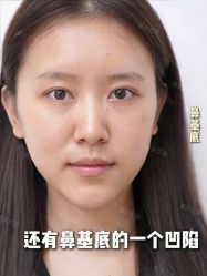 -Yestar重庆艺星医疗美容医院